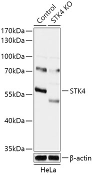 STK4 Polyclonal Antibody (100 µl)