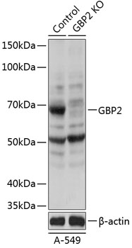 GBP2 Polyclonal Antibody (100 µl)