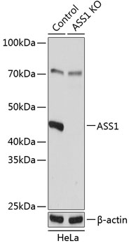 ASS1 Polyclonal Antibody (50 µl)