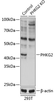 PHKG2 Polyclonal Antibody (50 µl)