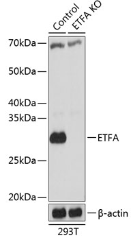 ETFA Polyclonal Antibody (100 µl)