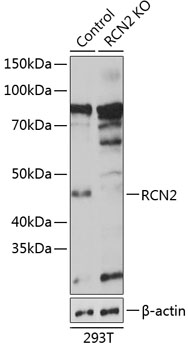 RCN2 Polyclonal Antibody