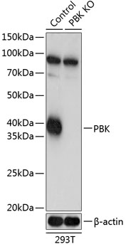 SPK Polyclonal Antibody (100 µl)