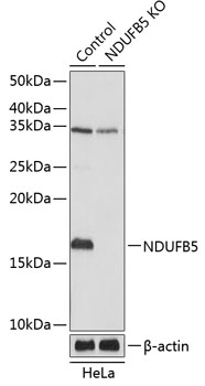 NDUFB5 Polyclonal Antibody