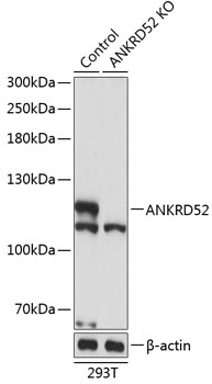 ANKRD52 Polyclonal Antibody (100 µl)