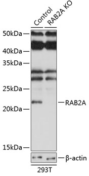 RAB2A Polyclonal Antibody (50 µl)