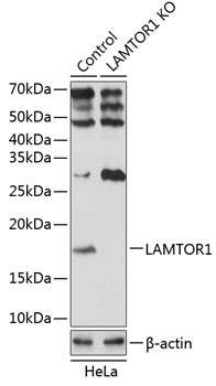 LAMTOR1 Polyclonal Antibody (100 µl)