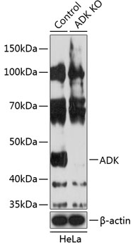 ADK Polyclonal Antibody (100 µl)