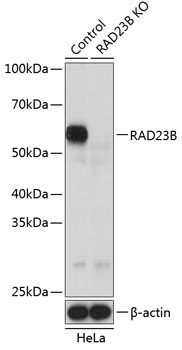 RAD23B Polyclonal Antibody (100 µl)