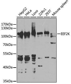 EEF2K Polyclonal Antibody (50 µl)