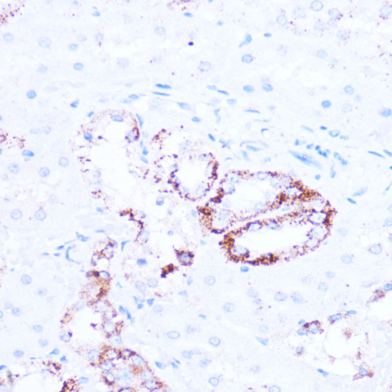 SIRT3 Polyclonal Antibody