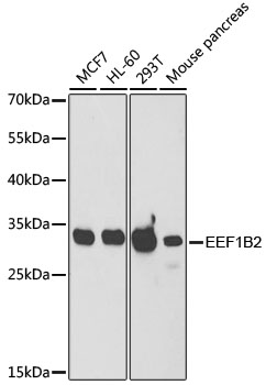 EEF1B2 Polyclonal Antibody (100 µl)
