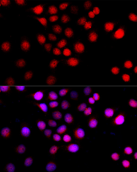 Beclin 1 Polyclonal Antibody (50 µl)