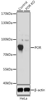 POR Polyclonal Antibody