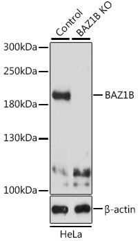 BAZ1B Polyclonal Antibody (100 µl)