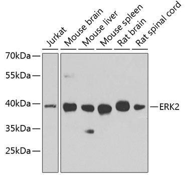 ERK2 Polyclonal Antibody (100 µl)