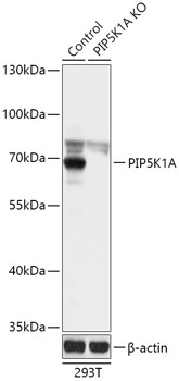 PIP5K1A Polyclonal Antibody (100 µl)