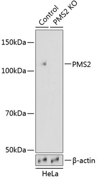 PMS2 Polyclonal Antibody (100 µl)