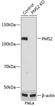 PMS2 Polyclonal Antibody (50 µl)