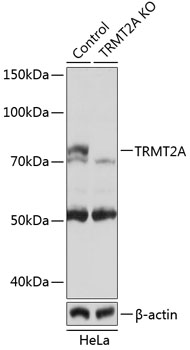 TRMT2A Polyclonal Antibody