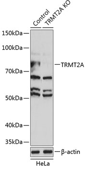 TRMT2A Polyclonal Antibody