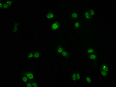 FOXO3 Recombinant Monoclonal Antibody [1E2] (50µl)