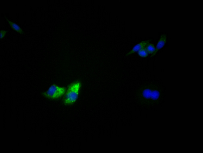 TP53 Recombinant Monoclonal Antibody [3D4] (50µl)