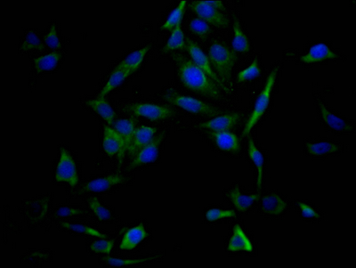 TP53 Recombinant Monoclonal Antibody [5C3] (50µl)