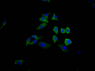 TP53 Recombinant Monoclonal Antibody [7A9] (100µl)