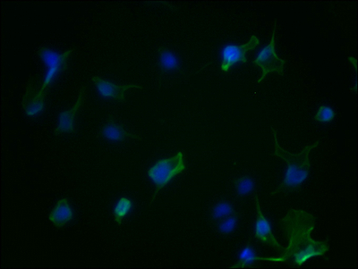 AURKA Recombinant Monoclonal Antibody [1H8]