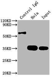 CDK4 Recombinant Monoclonal Antibody [8F2] (100µl)