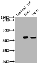 CDK6 Recombinant Monoclonal Antibody [8G3] (50µl)