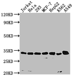 CDK4 Recombinant Monoclonal Antibody [8H4] (50µl)
