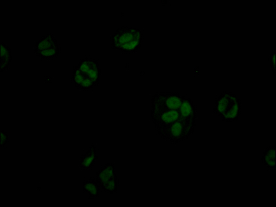 STAG2 Recombinant Monoclonal Antibody [3H4] (50µl)