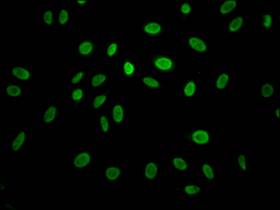 CCNE1 Recombinant Monoclonal Antibody [3A5] (50µl)