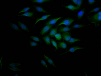 CCNE1 Recombinant Monoclonal Antibody [9H12] (50µl)