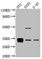 CCND1 Recombinant Monoclonal Antibody [5D8] (100µl)