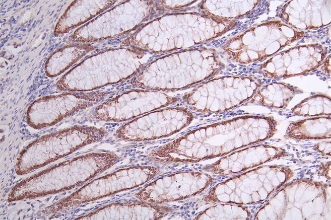 SATB2 Recombinant Monoclonal Antibody [3B12] (100µl)