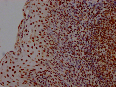 HMGB1 Recombinant Monoclonal Antibody [1A1] (100µl)