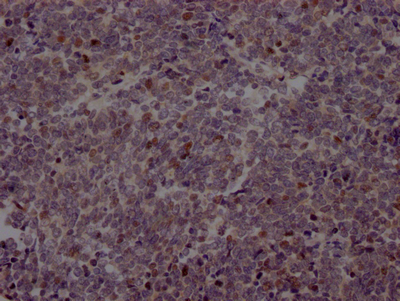 EZH2 Recombinant Monoclonal Antibody [2C7] (100µl)