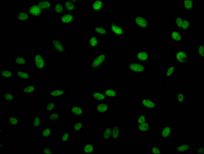 RBBP4 Recombinant Monoclonal Antibody [3E9] (50µl)