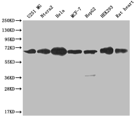 CBX2 Recombinant Monoclonal Antibody [24A2] (50µl)