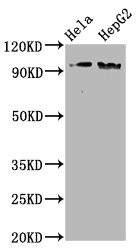 Phospho NBN (S343) Recombinant Monoclonal Antibody [1B4] (50µl)