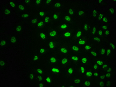 Phospho ATM (S1981) Recombinant Monoclonal Antibody [1C5] (100µl)