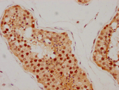 ATM Recombinant Monoclonal Antibody [4E11]