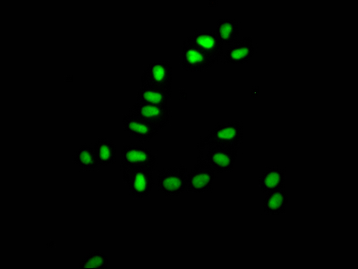 XRCC5 Recombinant Monoclonal Antibody [5G3] (50µl)