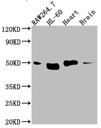 TINF2 Recombinant Monoclonal Antibody [5G11] (100µl)