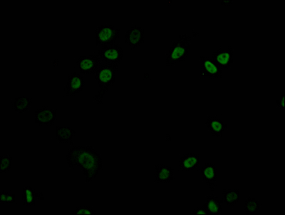 DNMT1 Recombinant Monoclonal Antibody [1A9] (50µl)