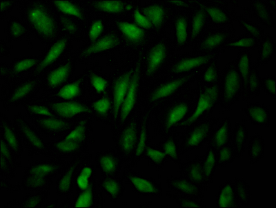 EPAS1 Recombinant Monoclonal Antibody [6A9] (50µl)