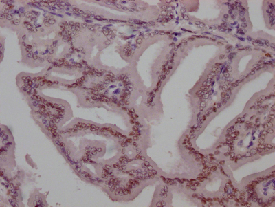 AR Recombinant Monoclonal Antibody [10A5]